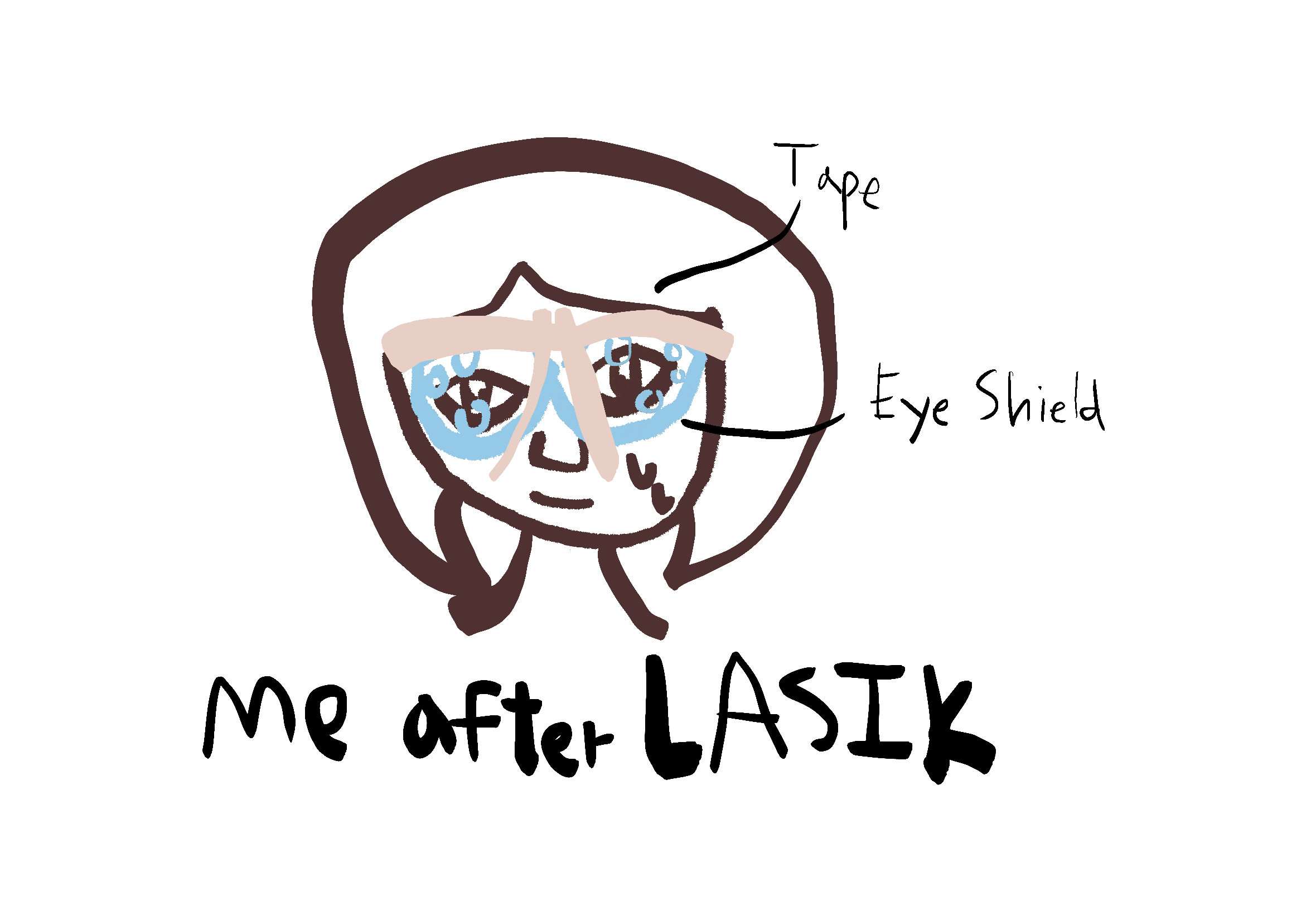 เหมือนติดตาแมวใส ๆ ทับตาทั้งสองข้าง มีเทปพาดเฉียง ๆ จากบนลงล่าง ปิดเทปข้างบนอีกเพื่อความแน่น